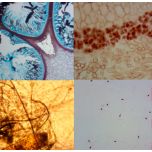 Bactéria Citologia e Fungos