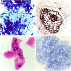 laminas preparadas bactéria e microbiologia