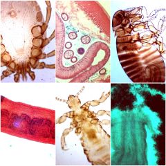 lamina preparada parasitologia