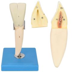 Dente Incisivo Inferior em 2 Partes