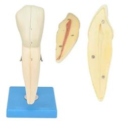 dente canino inferiror