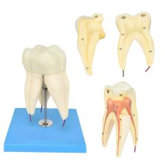 Dente Molar Superior com Raiz em 3 Partes